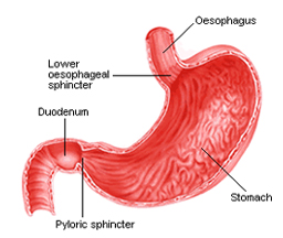 India Surgery Stomach Cancer, Cost Stomach Cancer Treatment, Cancer Care, Stomach Cancer Treatment India, Affordable Gastric - Duodenal Stomach Cancer Treatment