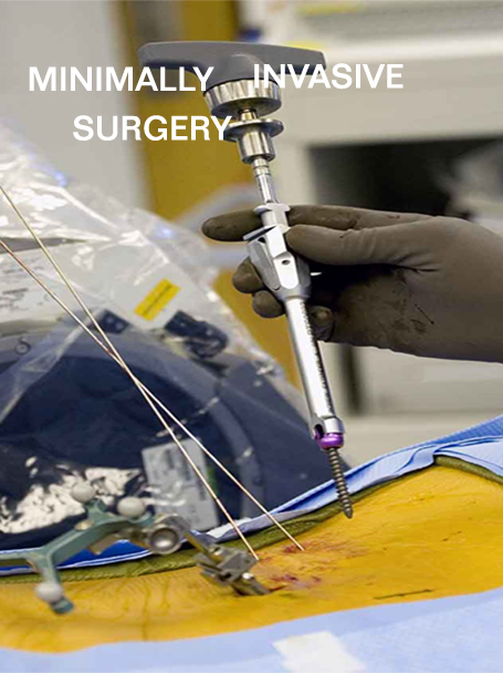 India Surgery Keyhole Surgery, Cost Keyhole Surgery, Keyhole Surgeon, India Laparoscopic Surgery, India Laparoscopic Treatments