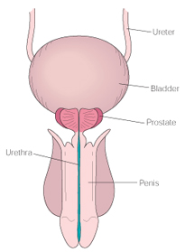 India Surgery Transurethral Resection Prostate, Cost TURP Surgery India, Transurethral Resection Prostate India Surgery