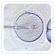 Cost TESE Testicular Sperm, India  Testicular Sperm Extraction Treatment, Testicular Sperm Extraction