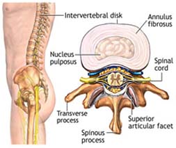 Information On Back Pain, Including Lower Back Pain, Back Pain Information
