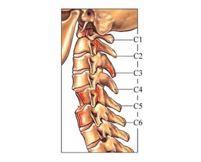 Infection, Tumors, Cervical Strain, Hospitals Of Neck Pain Surgery, Low Cost Neck Pain Surgery