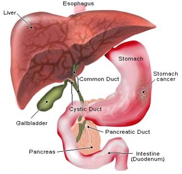 India Surgery Stomach Cancer, Stomach Cancer, India Surgery Stomach Cancer Treatment, India Surgery Symptoms
