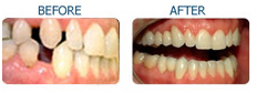 Cosmetic Dentistry India, Cosmetic Dentistry, India Dentistry, India Dental Surgeon India