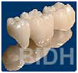 India Surgery Teeth Polishing Fluoride,Cost Teeth Polishing Fluoride