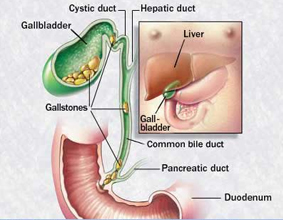 India Surgery Gallstone,Gallstones,Cost Minimally Invasive Gallstone, Gallstones Surgery, Gallstones