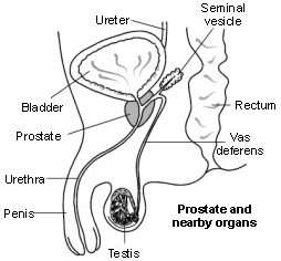 India Surgery Bladder Outlet Incision,Cost Bladder Outlet Incision, Bladder Outlet Incision Surgery India