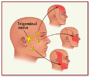 India Surgery Trigeminal Neuralgia,Cost Trigeminal Neuralgia Surgery