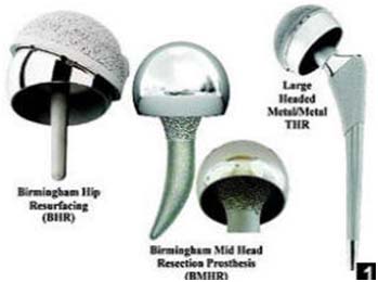 India Surgery Birmingham Mid Head Resection Prosthesis, India Cost BMHR