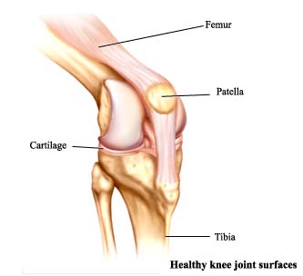 India Surgery High Flex Knee Replacement, High Flex Knee Replacement