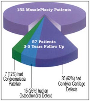 India Cost Mosaicplasty,Cost Mosaicplasty, Mosaicplasty Surgery