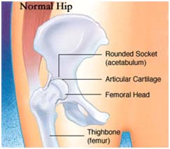 Cost Total Hip Replacement Surgery, Total Hip Replacement Surgery
