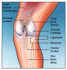 India Surgery Total Knee Replacement, India Cost Total Knee Replacement